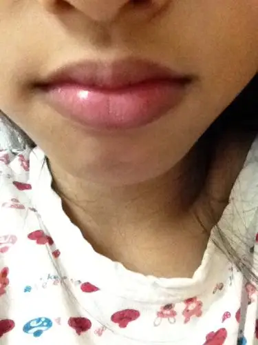 为什么我嘴唇是这种颜色?有心脏病吗?我妈也这样,是天生遗传的吗?