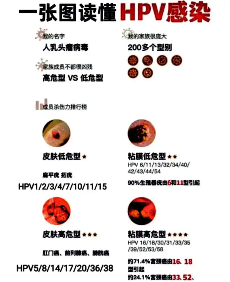 病毒带来的症状 hpv就是人乳头瘤病毒,现在我们提倡育龄女性定期检查