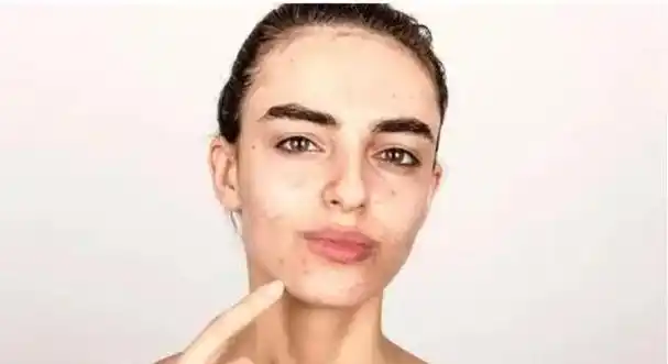 脸部肤色不均怎么办(额头跟脸部肤色不均)-正华文库