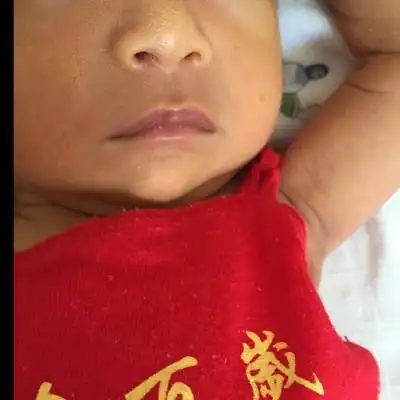 宝宝十一天,嘴周发青是什麼问题,怎麼办,和黄疸有没有关系啊