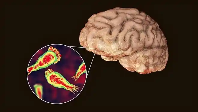 食脑变形虫再现美国能吃人脑子中国被感染患者全部死亡