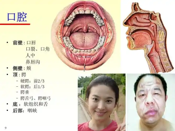 侧壁 : 颊   顶:腭 – 硬腭:前2/3 – 软腭:后1/3 – 腭垂 – 腭舌弓