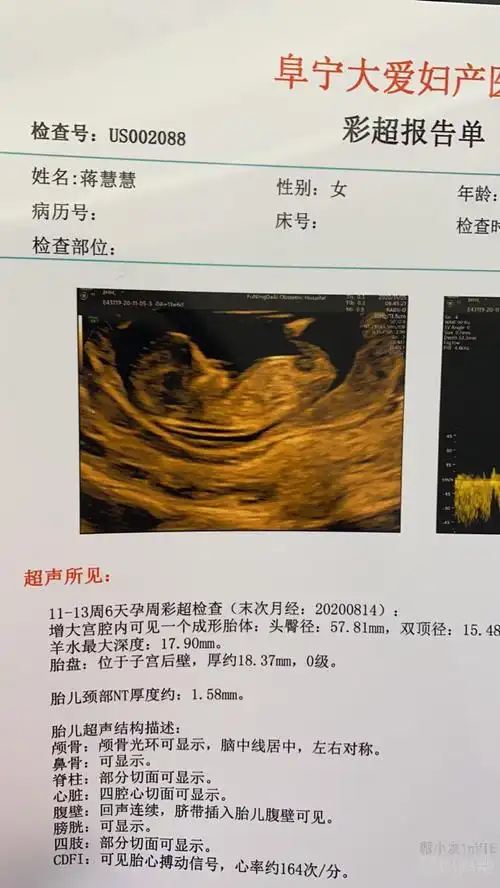 怀孕能分辨男女的症状 "半采红莲半白莲"-第1张图片-融科博客