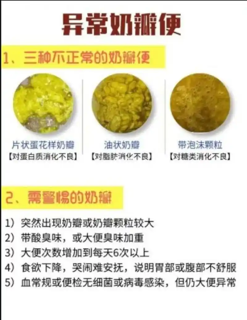 新生宝宝大便的颜色是否正常 新生宝宝在出生后的一周里,会排出不同