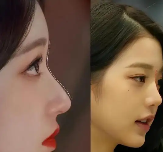 "鼻子"对女人的气质影响有多大?尤其这3种鼻型,容易拉低颜值