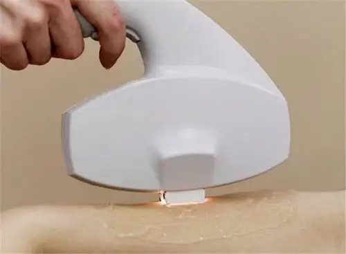 脱毛对比的搜索结果_360图片搜索