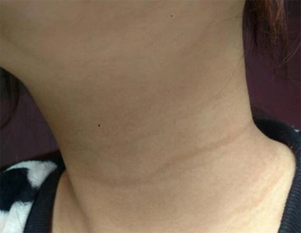 对于如果是在脖子咽喉处或者是喉结附近有痣,那么就是会有着的说法都