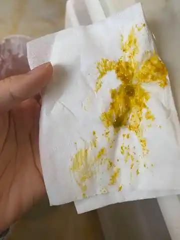 想咨询一下37天的宝宝拉的屎大部分都是黄色,但是掺杂着一些和果冻似