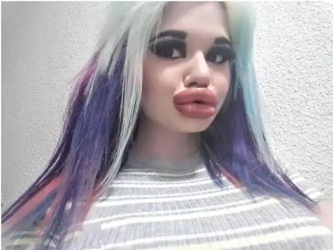 图集世界上最厚的嘴唇你们感受下