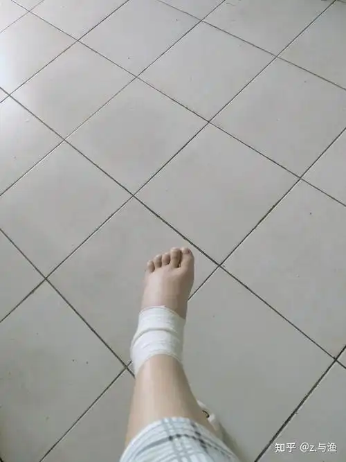 摔了,那时候就觉得好疼好疼,我愣在那里,坐在地上,一直抱着我的脚踝