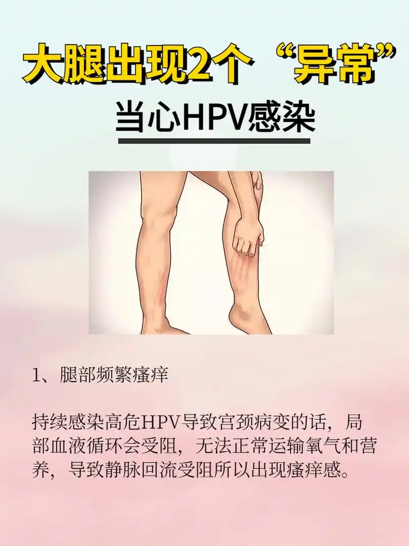大腿出现2个"异常",当心hpv感染  #hpv# #hpv感染# #hpv检查有什么
