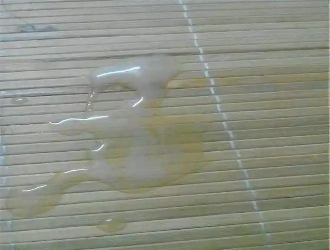 正常精子的参考图_有来医生