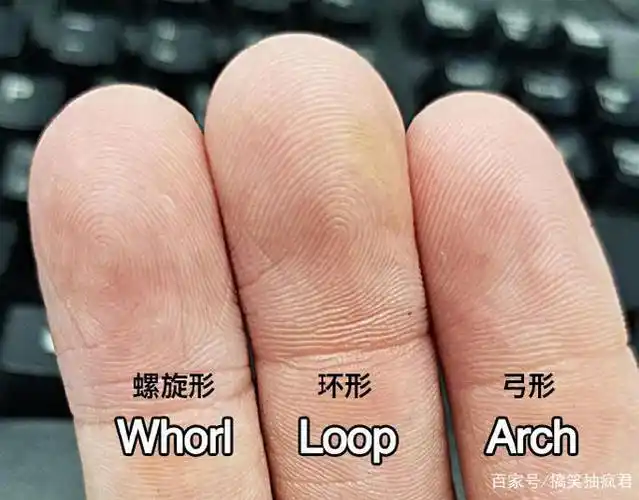 有5%的人有弓形指纹.