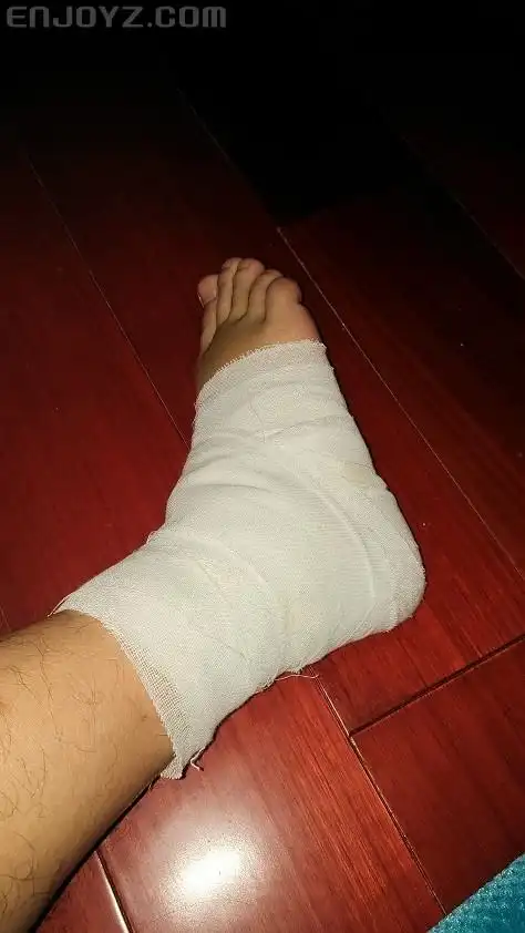 脚腕扭伤求问相同经历球友