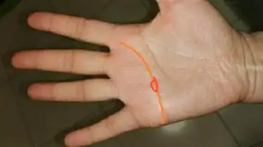 感情线出现这种岛纹会带来何种影响