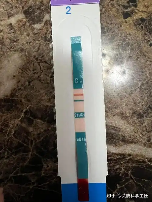 请问雅培四代和医院四代试剂差别大吗?