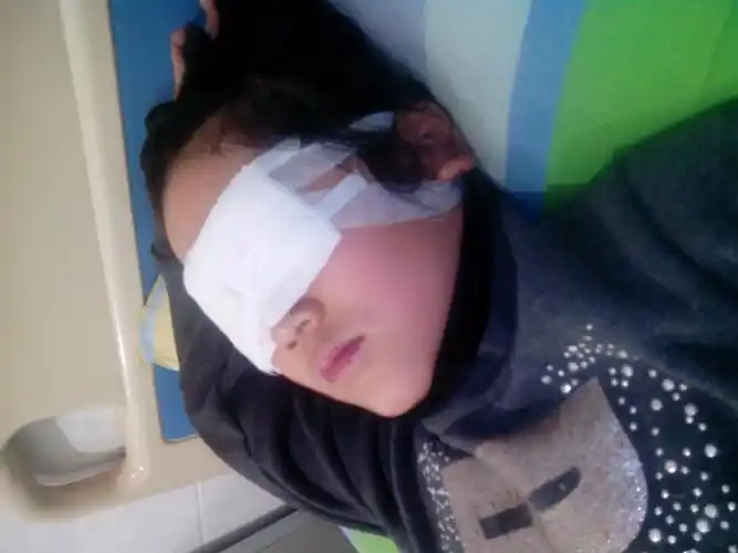 当时因为我的双眼被纱布蒙住,妈妈照顾我的起居生活就是难上加难.