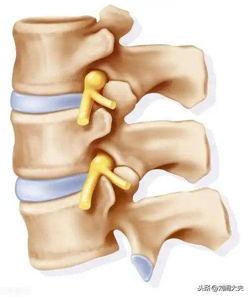 腰椎疼痛原来是腰椎的小关节紊乱造成的如何更好的治疗