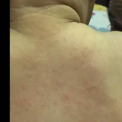 问答 婴儿期0-1岁 笨笨lf9个月28天2017-04-13 推荐回答