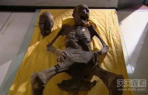 之间还有一块荷叶状的黑色粘连物,种种表现让看到她的人不禁产生疑问