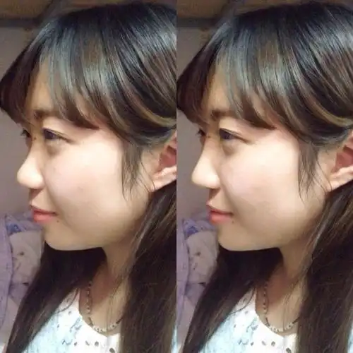 塌鼻梁是一种怎样的体验?