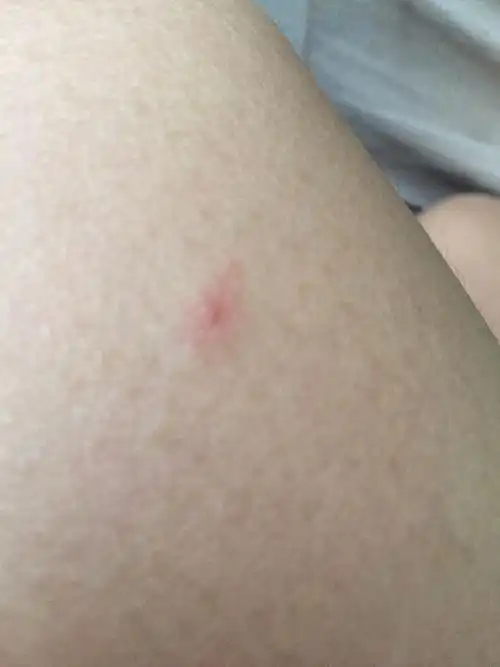 被小金毛的爪子抓破一点皮 不知道需不需要打狂犬疫苗 狗狗不到三个月