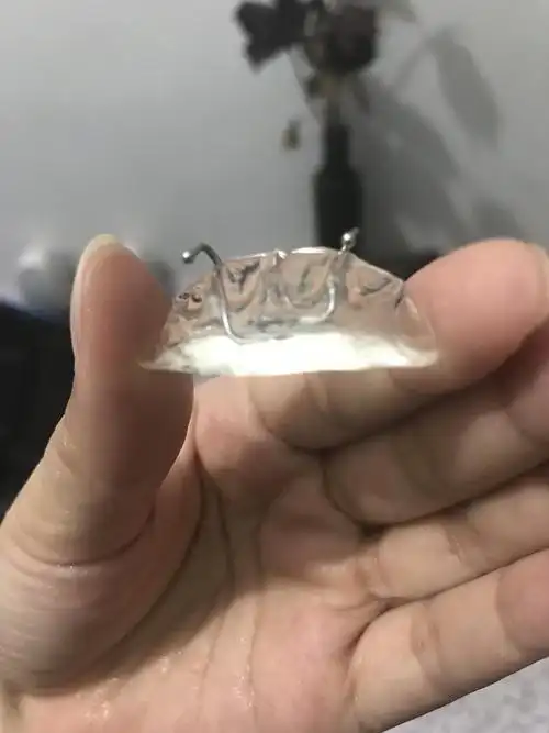 牙齿矫正深覆合之平导