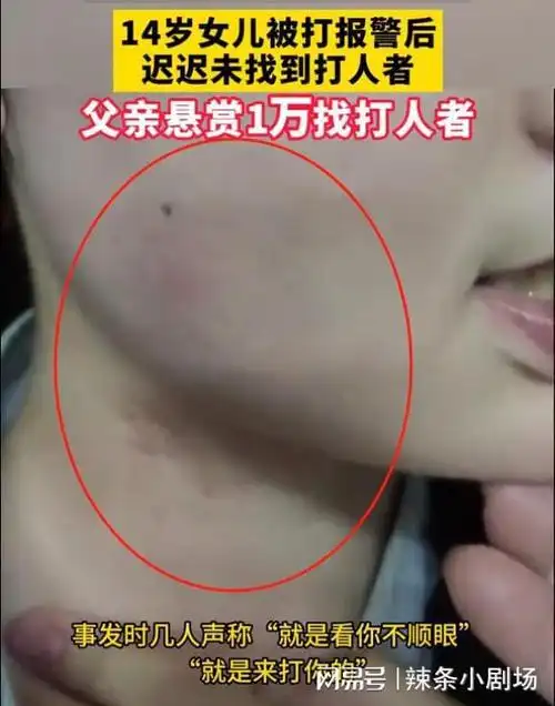 14岁女儿被打老父亲悬赏一万找人5名打人者已找到但很难判刑