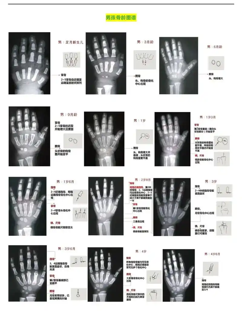 男孩骨龄对照图,有拍过骨龄片的 - 抖音