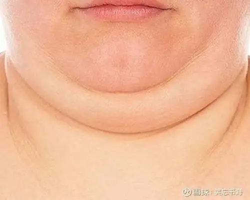 比较典型的就是弓背久坐,脖子前伸或睡觉枕头过高等导致下巴低于水平