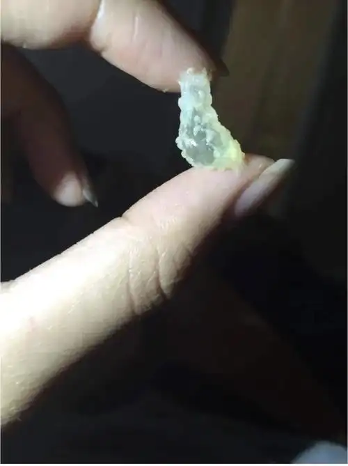 仔细看图3里似乎能看到5周大小的胚胎 67