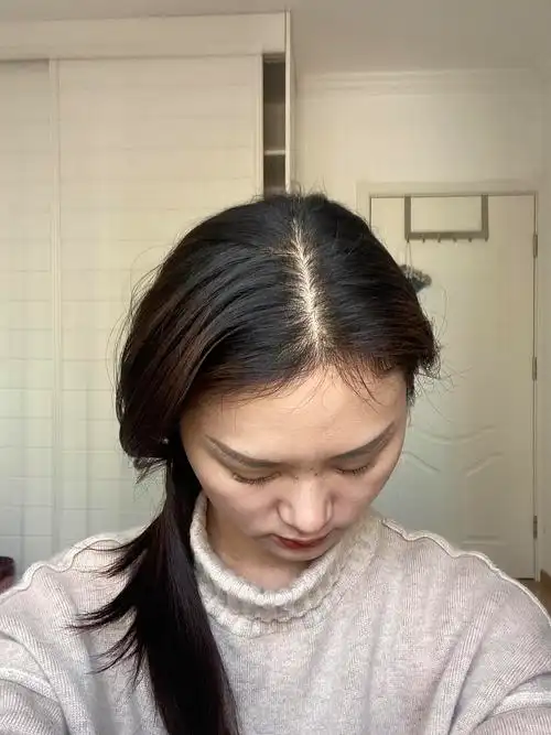 家人们我这个头顶正常吗