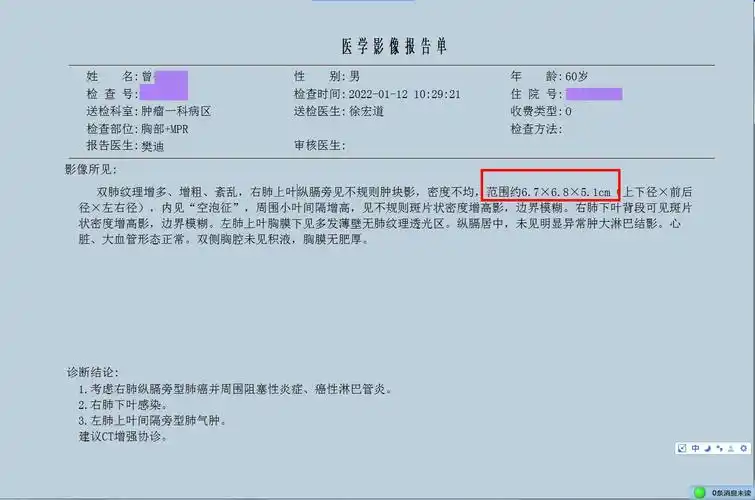 微创治疗40天后7厘米的肺癌消失不见了