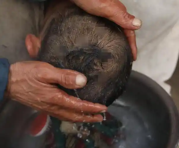 老人头上生虫子后来怎样了 故事:贵州8岁男童患怪病(9)