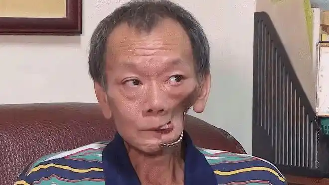 槟榔的危害我们常常看到很多人因为嚼槟榔,牙齿开始变红,变黑,甚至是