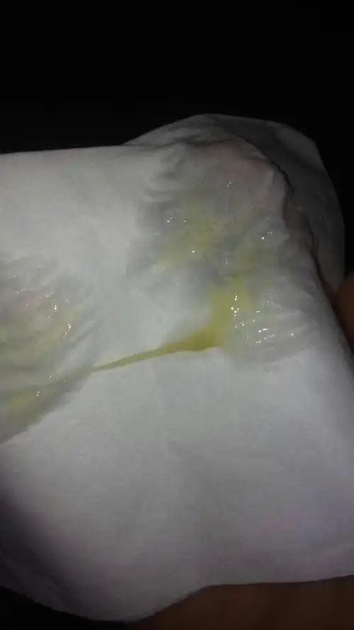 一到冬天喉咙里面痰就比较多,鼻子老是一个通的一个不通,下面这个是