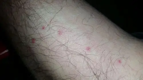 艾滋病医生请进 我有一次高危行为,我两周,和六周,还有五个月后,还有