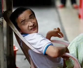 小儿强直型脑瘫护理