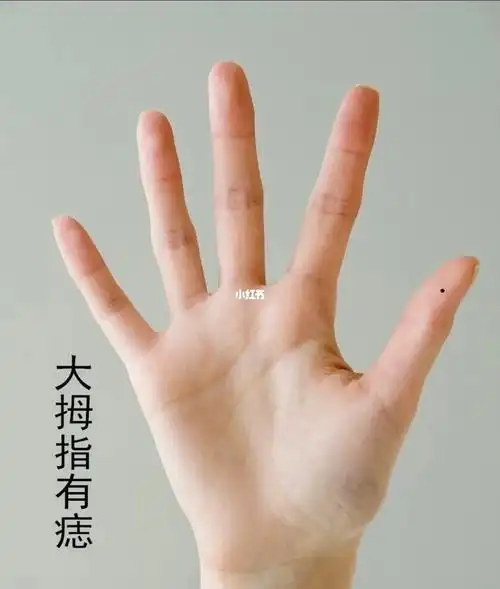 手相大拇指各处的痣都有什么含义: 大拇指第一节有痣:表示此人性格