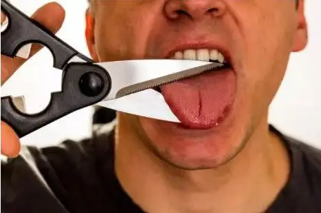 患舌癌割舌头,都是槟榔惹的祸?这些人也要随时当心!