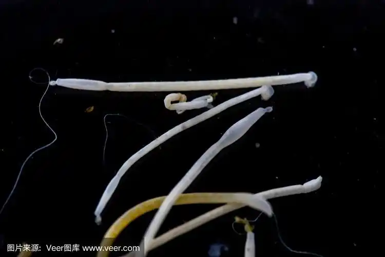 蠕虫,寄生的,棘头虫,荆棘,实验室