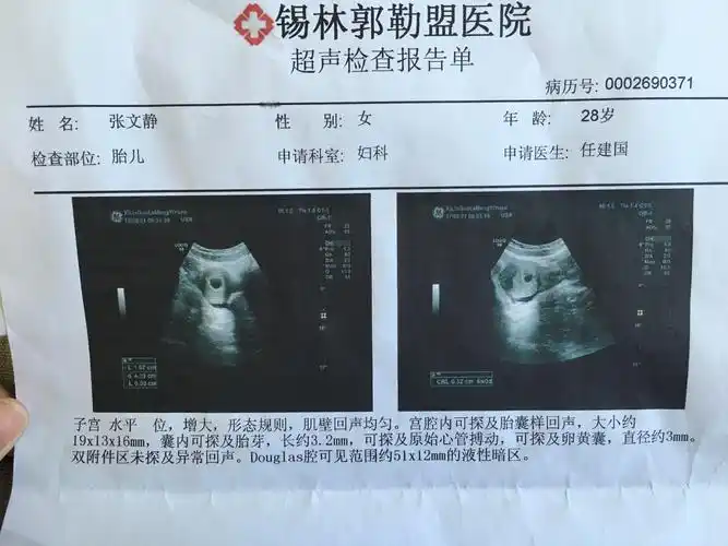 拜托各位老师给看一下这是怀孕六周的体检报告