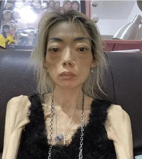 世界上最瘦的女孩(女星瘦起来能有多可怕?