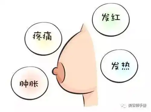 乳头痛是怎么回事?