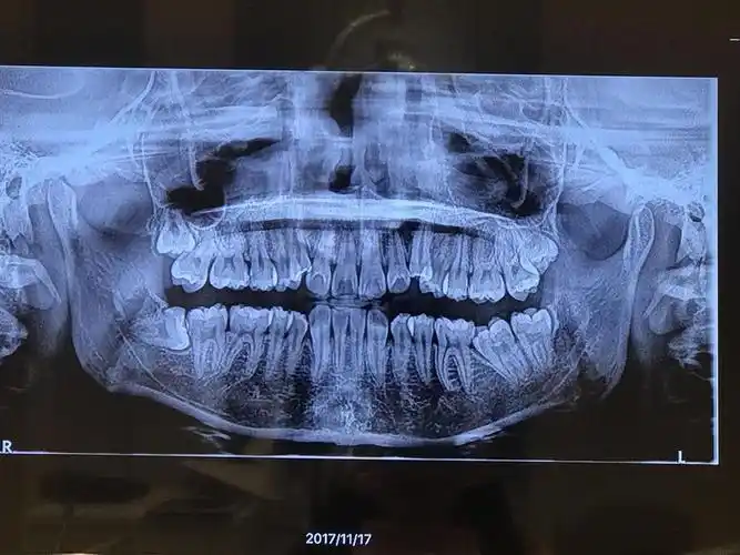 我也来晒晒我的牙片请大佬来看看07怎么样
