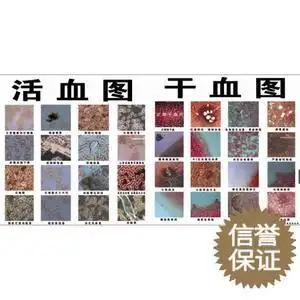 一滴血检测挂图