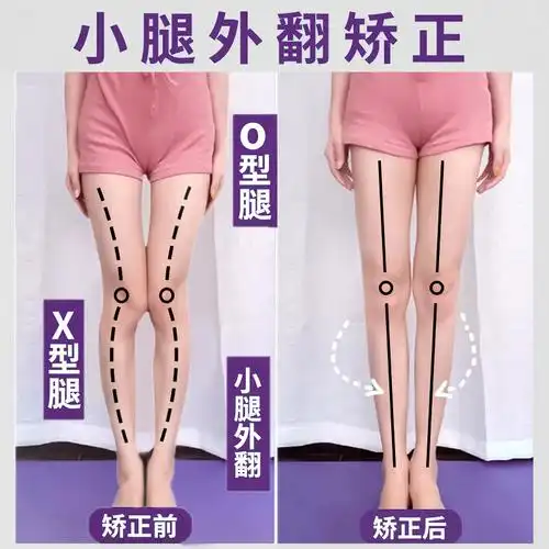 小腿外翻矫正腿型神器直腿纠正xo型腿增长高足弓护脚火山磁石鞋垫