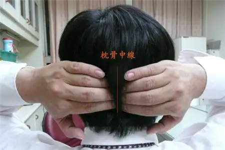 后脑勺有个骨头突出