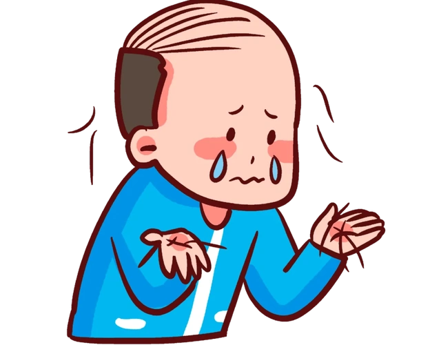 健康科普脱发挂什么科