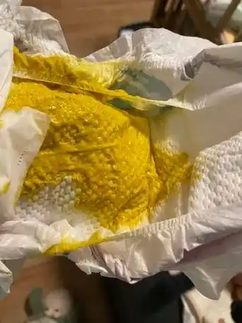 宝宝粑粑有黏液正常吗